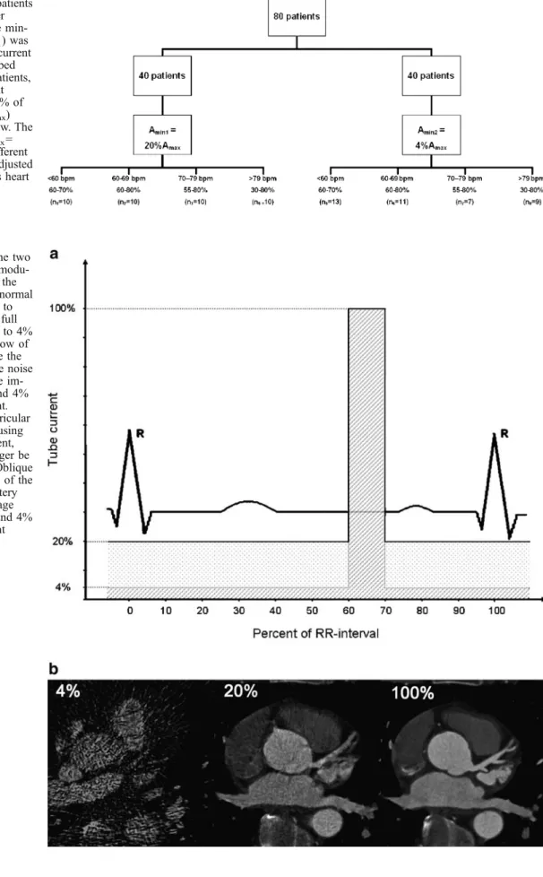 Fig. 2 a Illustration of the two ECG-based tube current  modu-lation algorithms used in the study