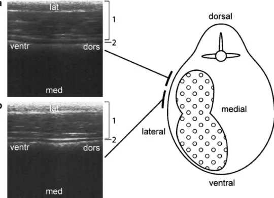 Fig. 4 Ultrasonographic find- find-ings and interpretation with  re-spect to the stratification of the dorsal rumen contents (in two levels, a and b) of a browse-fed, captive moose (A