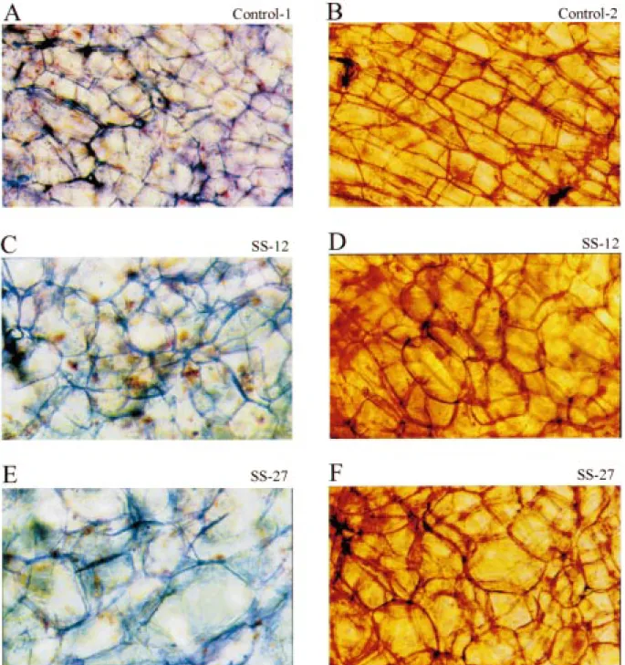 Figure 6. Phenotypical changes in mature storage parenchyma cells of antisense tap roots