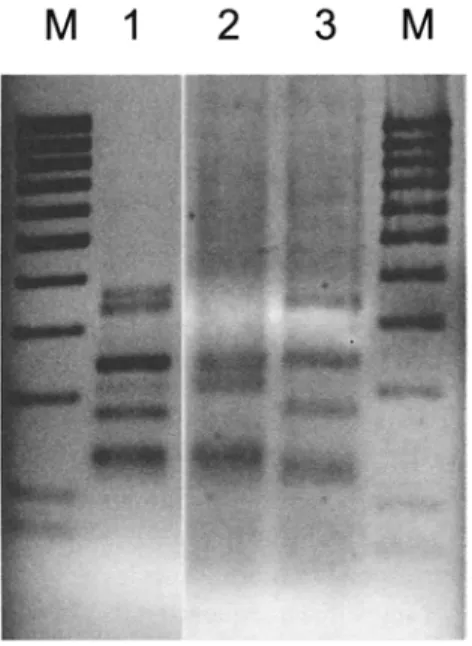 Fig. 1. Screening of PCR products and cloned PCR products by RFLP analysis. Depicted are restriction patterns  of PCR products (primers GLOM 1310flTS4i) digested with the restriction enzyme  Hinfl