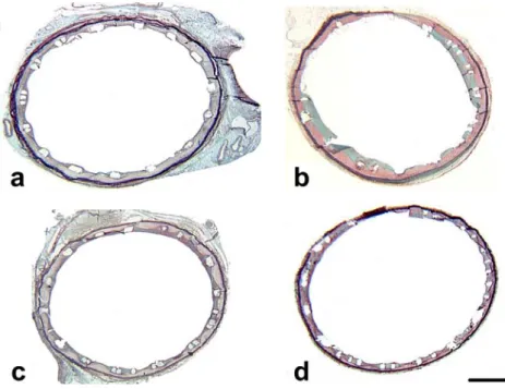 Figure 4 Flype stent—full vessel images (magnification circa 20 × ), Histological sections at a) 7 days FU b) 30 days FU c) 90 days FU and d) 180 days FU, Movat pentachrome stain, bar lenght = 1 mm.