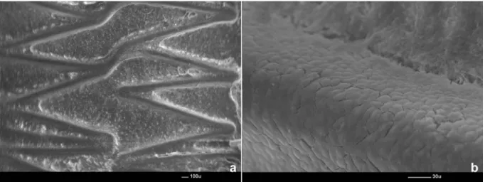 Figure 6 SEM of 7 days FU Flype stents a) Confluent and regular carpet of neo-endothelial cells, 31 × b) Detail of the previous image showing neo-endothelial cells with the typical rhomboid shape covering stent strut, 340 × .