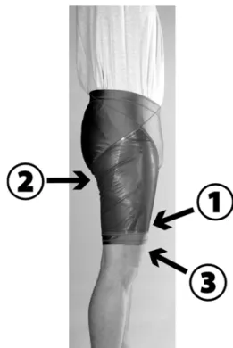 Fig. 3 Garment for thigh cooling. The three-layer laminate is part of short pants, which can be opened for easier dressing on the inner thigh side with a hook and loop fastener