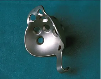 Fig. 1 Image of acetabular reinforcement ring with a hook (ARRH)