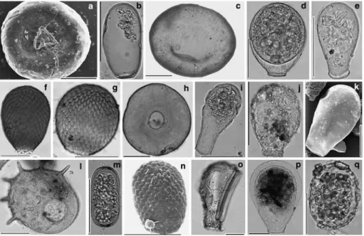 Fig. 1 Light- and scanning electron micrographs of some testate amoebae found in peatlands, illustrating the range of morphological variability; (a) Trigonopyxis arcula, (b) Hyalosphenia subXava, (c) Bullinularia  in-dica, (d) Nebela tincta, (e) Nebela mil