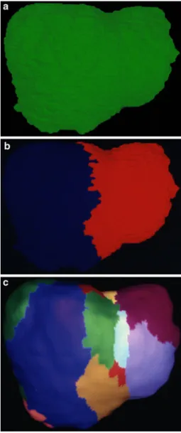 Fig. 3 Portal venous segmentation of the liver, in function of the level of the portal venous branching pattern considered