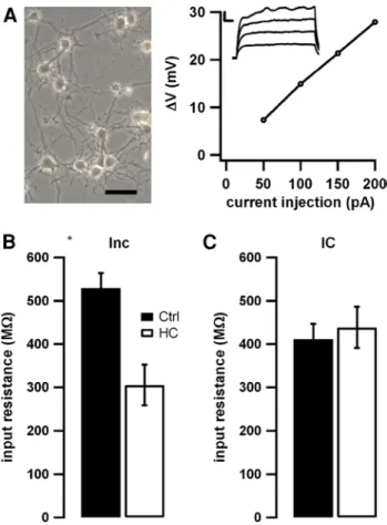 Fig. 1   Homocysteine effects on passive properties of hippocam- hippocam-pal neurons