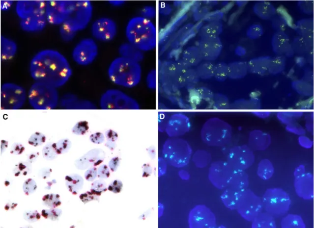 Fig. 3 Different amplification patterns in cluster forming chromo- chromo-somal gain on 17q