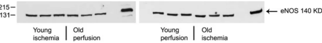 Figure 1. Western blot analysis of eNOS protein expression in cardiac tissue of young and old rats