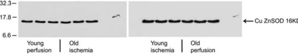 Figure 3. Western blot analysis of Cu,ZnSOD in young and old control-perfused or ischemic-reperfused rat hearts.