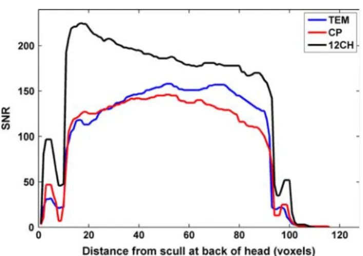 Fig. 4 SNR profiles through the center of the brain along the posterior–