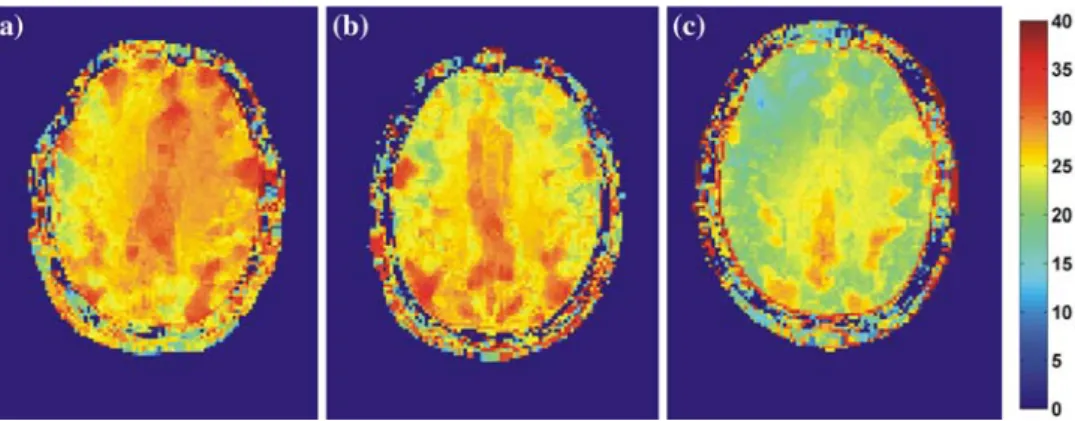 Fig. 6 Maps of the effective flip angle for α nominal = 30 ◦ in human brain of a single representative volunteer for a TEM coil, b CP coil, and c 12-channel phased array coil (body coil)