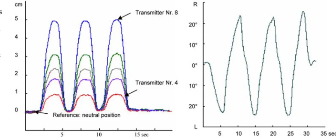 Fig. 3 ZEBRIS motion analysis (changes of distances and angles) plotted for flexion/extension (left change of distances) and lateral bending range (right change of angles)