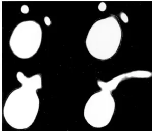 Fig. 4 3D representation of the aneurysm extracted from rota- rota-tional digital subtraction angiography data