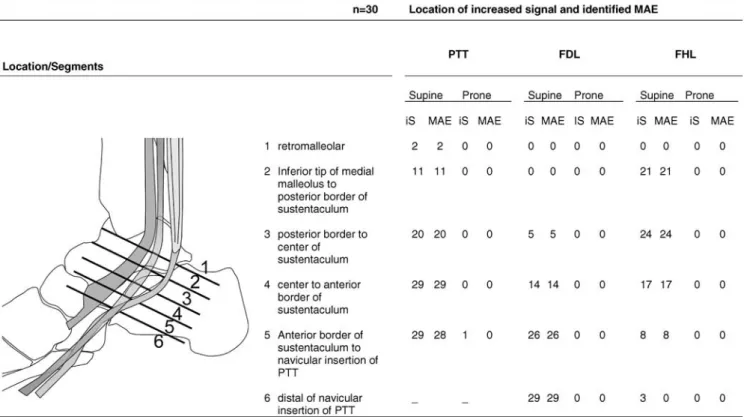 Table 3 Medial tendon group: location and prevalence of increased signal on T1-weighted images (iS) and magic angle effect (MAE) depending on positioning [supine (neutral position of the foot) vs prone (plantar flexion of the foot) position] (PTT posterior