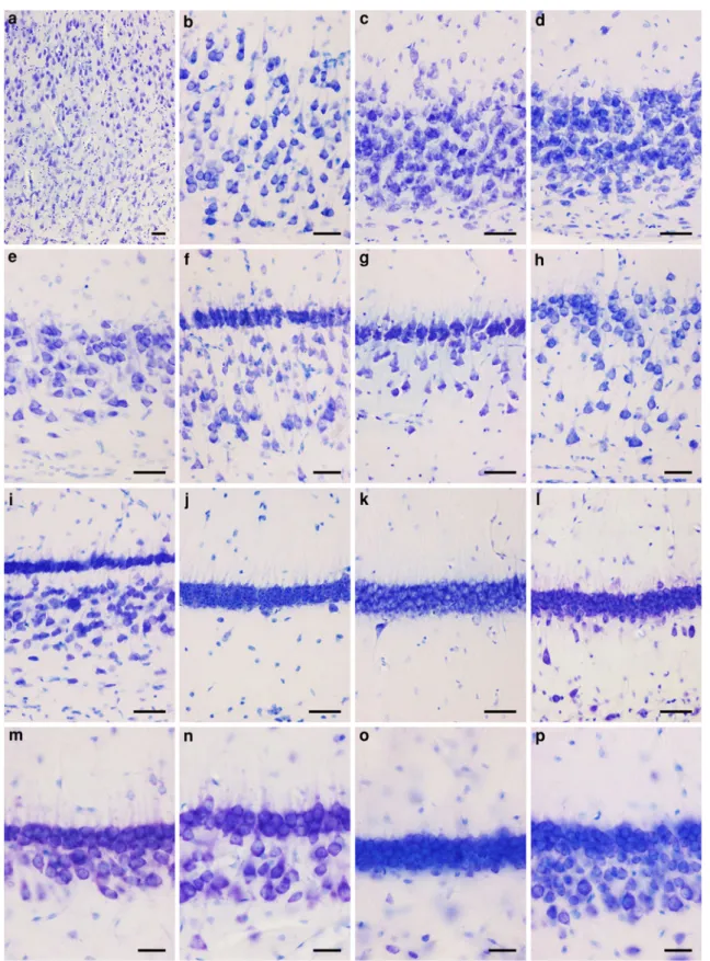 Fig. 2 Nissl-stained CA1 pyramidal cell layer. Unless noted other- other-wise, images were taken at mid-proximodistal and mid-septotemporal locations