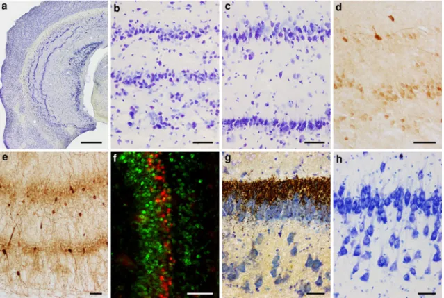 Fig. 3 a Hippocampus of a mouse carrying the Reln orl reelin mutation. b Two distinct cell layers and deep cell clusters in the septal mid-proximodistal CA1 of a Reln orl mouse
