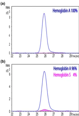 Figure 4. Reversed-phase nano HPLC chromatograms for hemoglobin β chains. In blue, the extracted ion chromatogram of three transitions specific to hemoglobin A β chain (836.1m/z → 694.4m/z; 823.4 m/z; 951.5m/z, corresponding to [M+ 19 H]