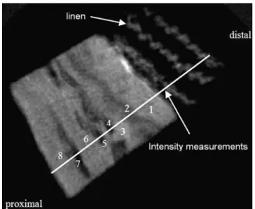 Fig. 5 Boxplot of median CT attenuation. The tissue can be differentiated by applying different X-ray spectra and analysing the differences in attenuation (HU 80kV – HU 140kV ) as demonstrated in Johnson et al