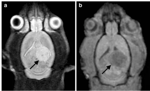 Fig. 1. The axial MRI scans of the rat brain clearly depict the F98 glioma in the left  temporo-parietal cortex