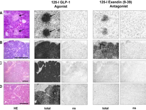 Fig. 3 Comparative in vitro GLP-1 receptor autoradiography with the