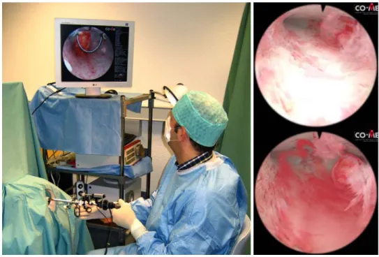 Table 1 VR metrics for the evaluation of diagnostic hysteroscopy