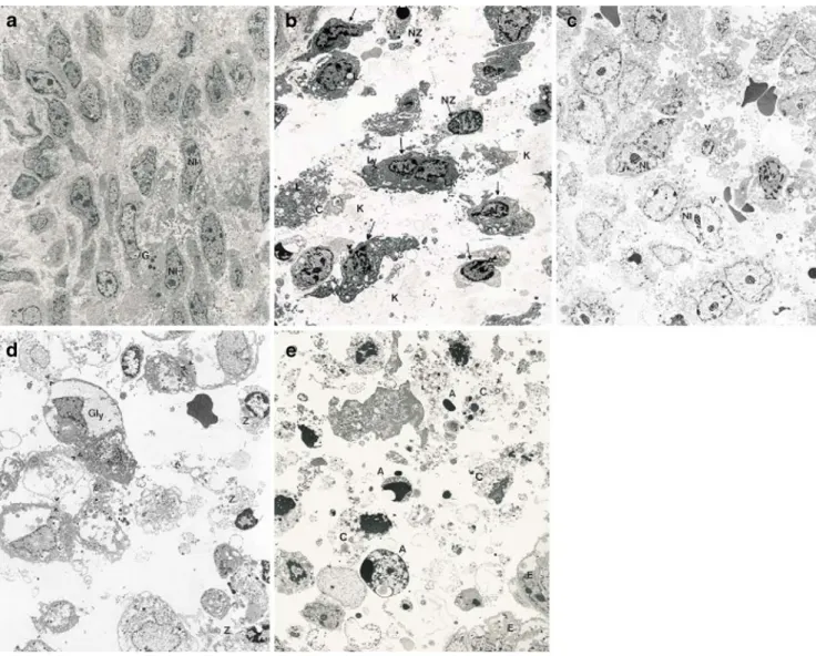 Fig. 2 Endometrial stromal cells. a Intact cell at the time of sampling.