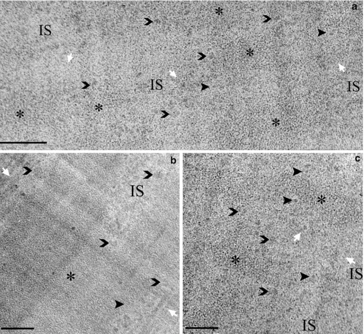 Fig. 3 A cryosection of a CHO cell nucleus. In a and c, condensed chromatin (*), recognisable by its characteristic ﬁne granularity, occurs as small numerous islands inside the nucleoplasm,  sur-rounded at its periphery by a narrow region (white short arro