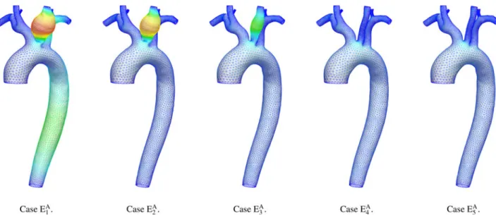 FIGURE 4. Wall displacement magnitude comparison, at the end-systole of the second heart beat (t 5 1.2 s), for the sets of values given in Table 3 (elastic behavior of the external tissues) of the 3-D aorta (see Fig