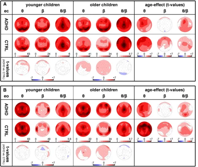 Fig. 2 Spectral analysis of children’s resting EEG (ICA-corrected, average referenced) for a eyes-closed (ec) and b eyes-open (eo) conditions