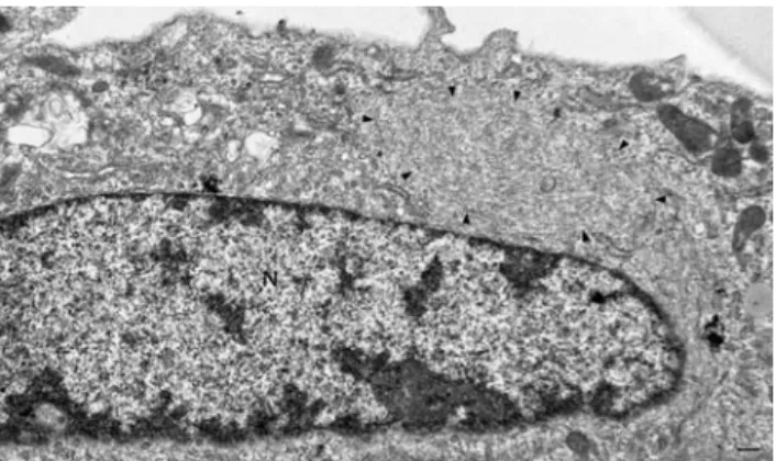 Fig. 2 Keratin 18 is undetect- undetect-able in clone 9 hepatocytes. 