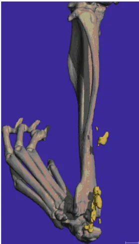 Fig. 4. 3D reconstruction of a mouse hind limb with heterotopic ossifications highlighted in yellow .