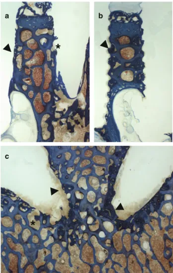 Fig. 8 Close-up view of adjacent new bone with the implants of group A and B shows excellent new bone formation (dark bone matrix) within the bone marrow cavities, where no polymer intruded (arrowheads)