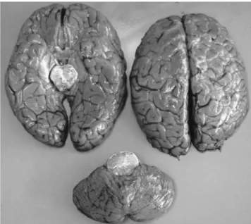 Figure 1. Brain: massive congestion and edema.