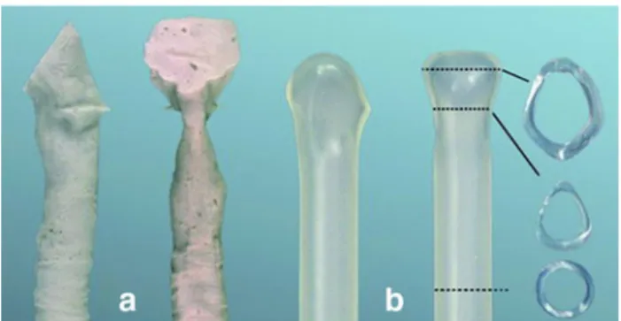 Fig. 2 LT-Mold TM . Per size, the prosthesis exists in four different lengths to accommodate different positions of the tracheostomy site