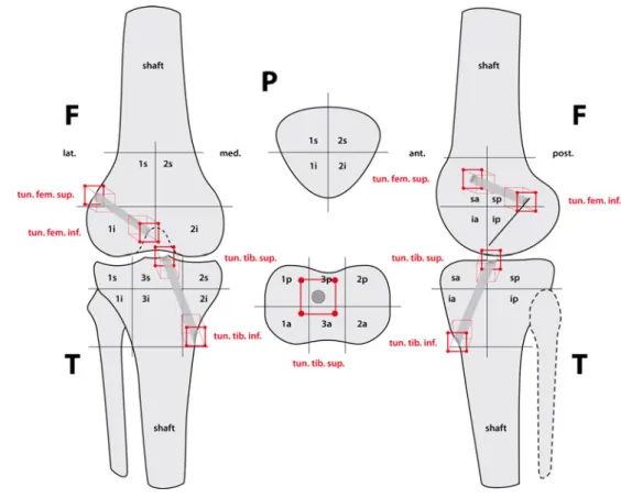 Fig. 2 Illustration of performed measurements indicating tibial and femoral tunnel orientation and position (1 anatomical femoral axis, 2 transepicondylar axis, 3 anatomical tibial axis, 4 tibial condylar axis, 5 and 6 medial and lateral tibial spines, 7 m