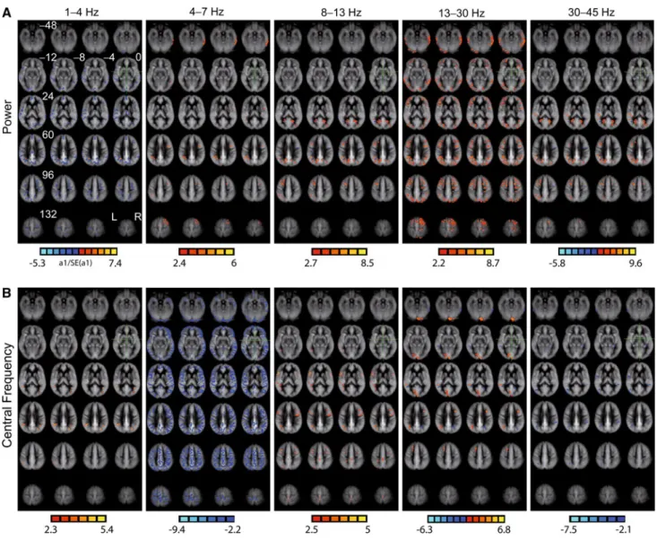 Fig. 1 Resting whole-brain perfusion correlations with eyes-closed EEG power and central frequency