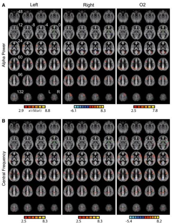 Fig. 2 Resting whole-brain perfusion correlations with locally restricted eyes-closed EEG alpha power and central frequency