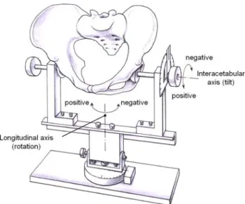 Fig. 1 A diagrammatic illustration shows the holding device used in the cadaver experiments