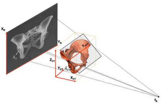 Fig 1. Schematic representation of 2D – 3D registration for determination of cup orientation from single standard X-ray radiograph.