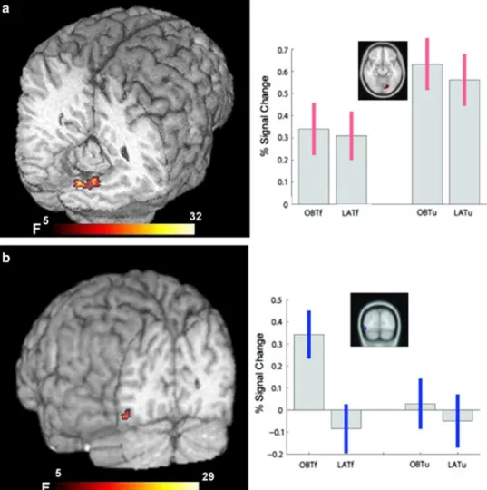 Fig. 4 fMRI data: Main effect of Body and interactions.