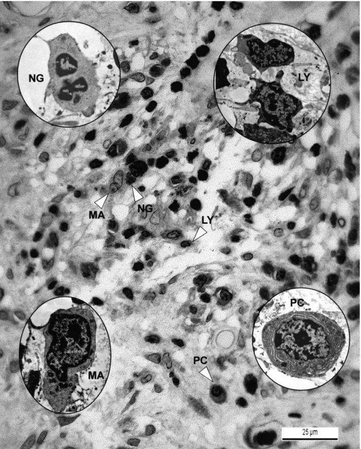 Fig. 3 A high-power light-microscopic view of the inﬁltrate shown in Fig. 2d. Note the numerous lymphocytes (LY) and plasma cells (PC) with occasional macrophages (MA) and neutrophils (NG) in the inﬁltrate