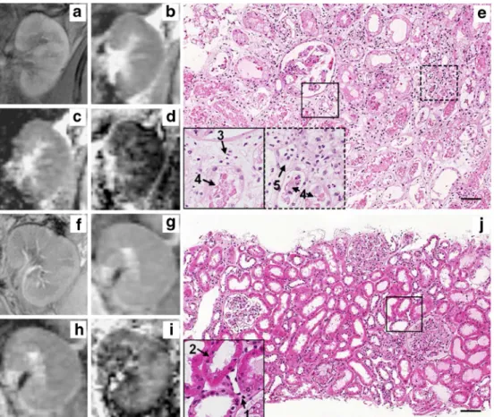 Fig. 3 Perfusion fraction, F P (%), in cortex (a), medulla (b) and