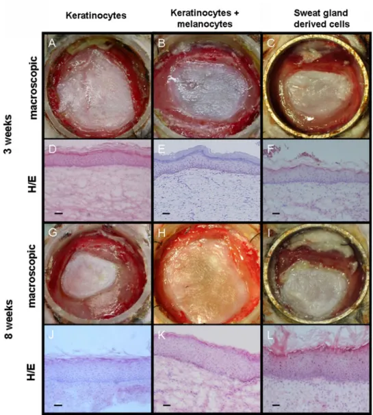 Fig. 2 Tissue engineered human skin analogs constructed with either keratinocytes, keratinocytes and melanocytes, or with sweat gland derived cells 6 and 8 weeks after transplantation