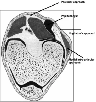 Fig. 4 Surgical approaches