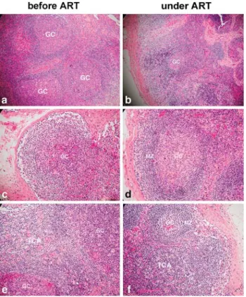 Figure 1. Lymph node architecture in an HIV-infected patient before and after antiretroviral therapy (ART)