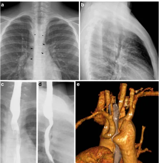 Fig. 9 a, b Isolated LSA in a 1-day-old boy. Volume-rendered contrast-enhanced MR angiogram