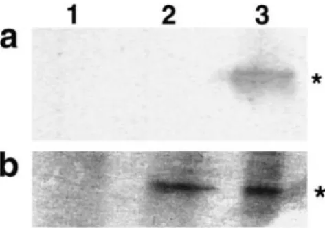 Fig. 6 Expression pattern of ANTR2 in Arabidopsis. Western blotting was performed with equal loading (50 lg) of protein isolated from roots (lane 1), leaves (lane 2), inﬂorescence stems (lane 3), green siliques (lane 4), and ﬂowers (lane 5)