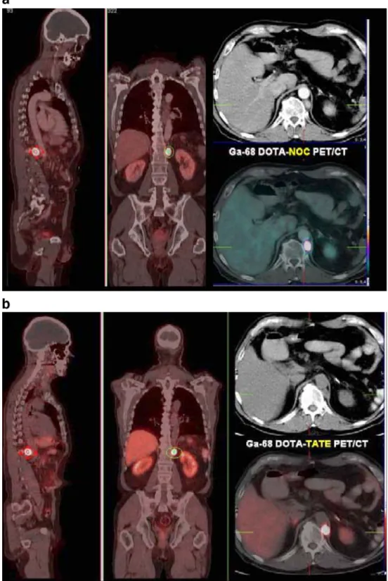 Fig. 3 Comparison between