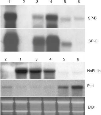 Fig. 3 NaPi-IIb, Pit-1, and SP-C mRNA expression in cultured L2 and AT II cells and in rat lung